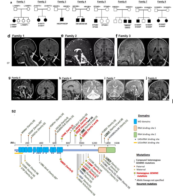 文献速递|GEMIN5基因功能丧失突变导致神经发育障碍