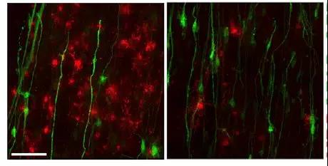 新干细胞模型可用于测试罕见神经系统疾病的治疗方法 潘文宇 赛基论道 2018-09-19